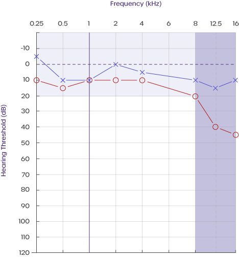 Audiogram-with-extended-frequencies.jpg