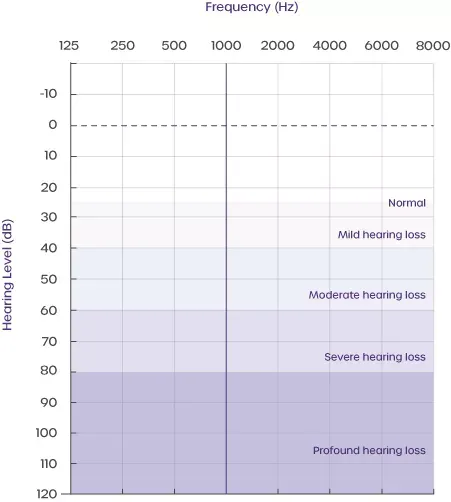 hearing-loss-categorisation